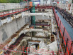 Une opération complexe